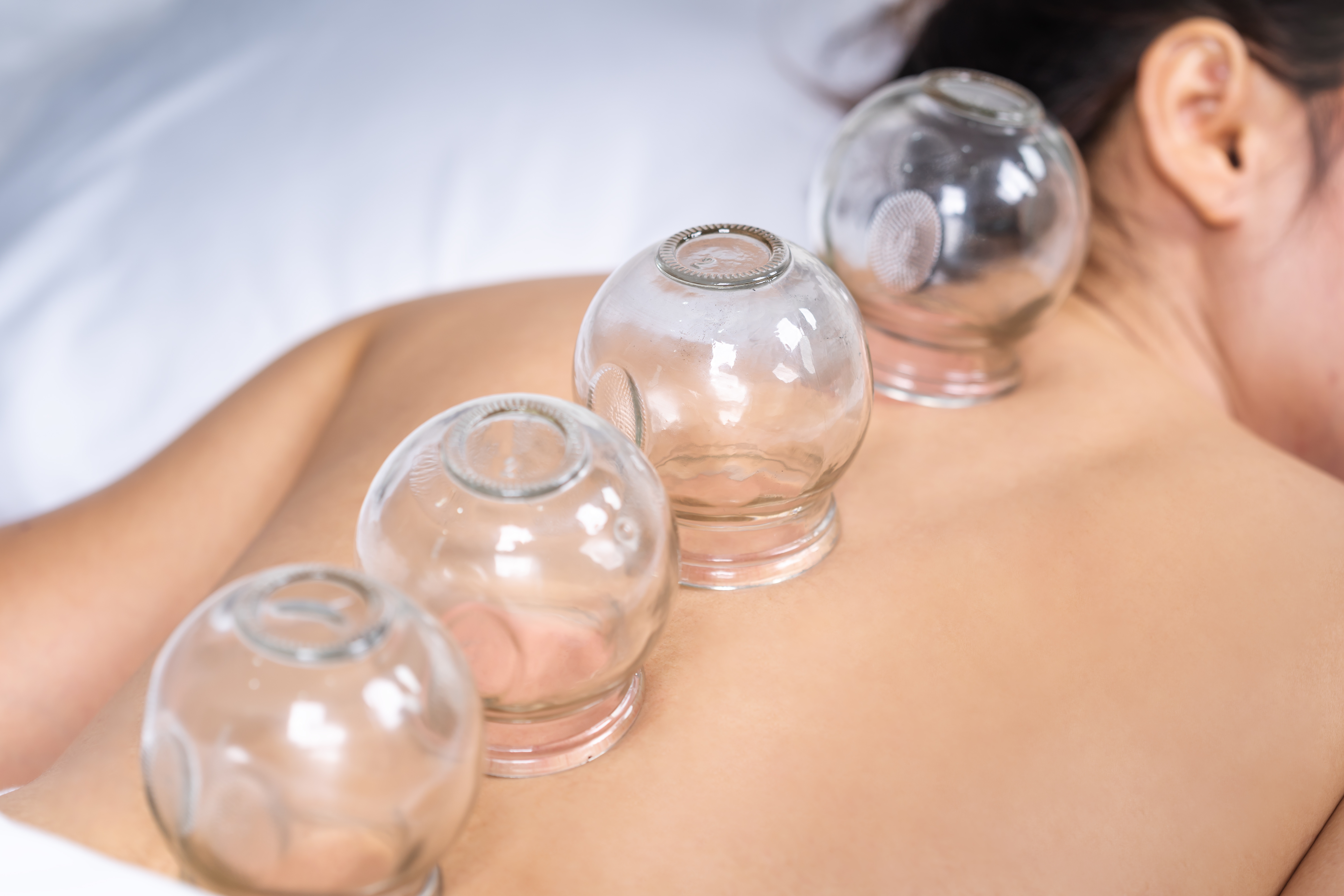 Logo related to Experienced Male Cupping Therapist